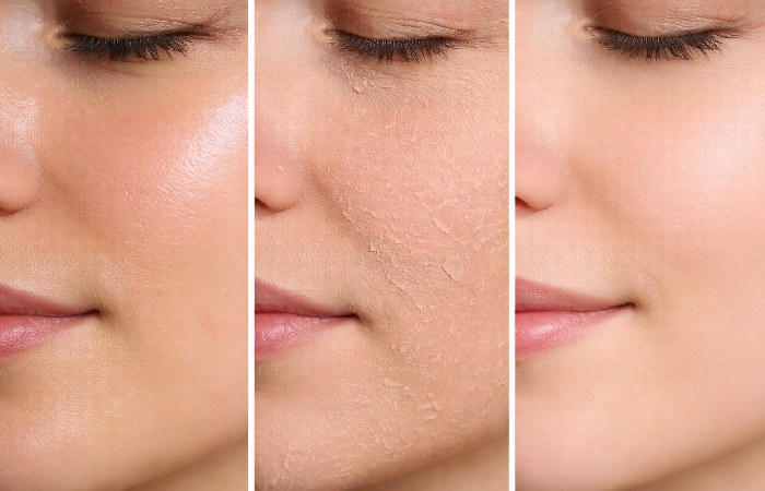 close view of different facial skin types textures